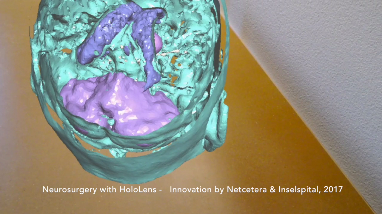 Hololens im Einsatz fuer die Neurochirurgie - Bild 1